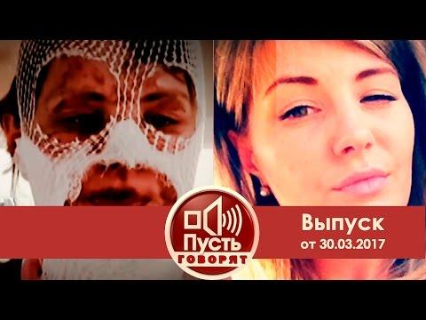 Пусть говорят - Вспышка ревности. Выпуск от 30.03.2017